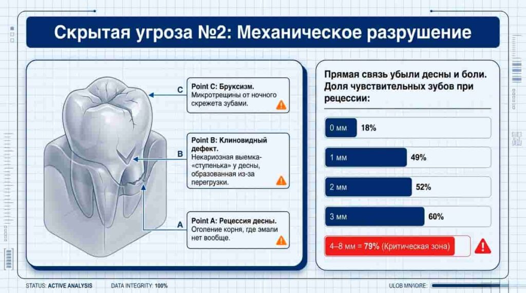 Механическое разрушение зуба